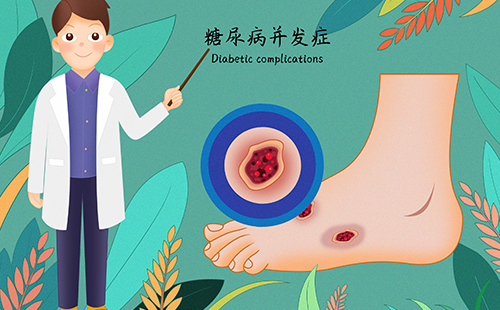 足底压力分析仪检测糖尿病足
